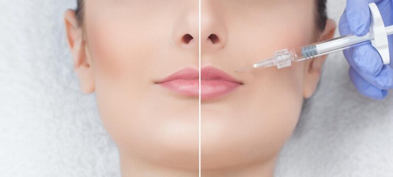 luminary-injectablkes-before-after-cover_01