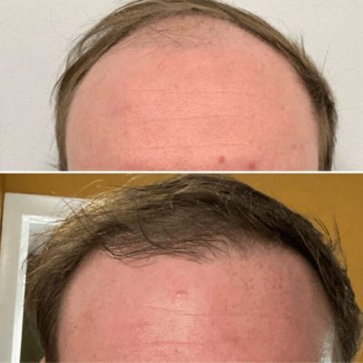 before-and-after-wp-gallery00-6-1024x662